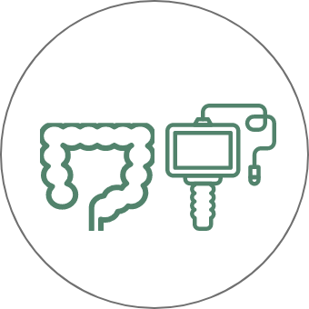 大腸内視鏡検査(大腸カメラ)について